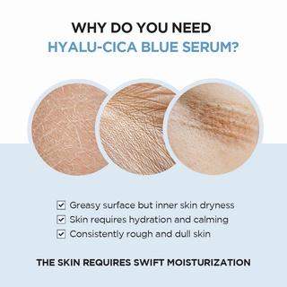 SKIN1004 Madagascar Centella Hyalu-Cica Blue Serum 50ml - 3