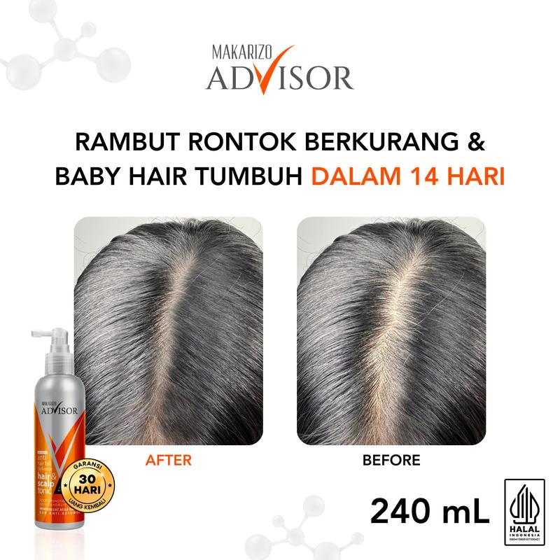 Makarizo Advisor Hair & Scalp Tonic 240mL - 2 in 1 Untuk Rambut Rontok dan Ketombe / Memperkuat Akar Rambut - 2